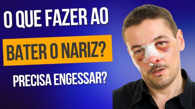 Como Identificar uma Fratura no Nariz