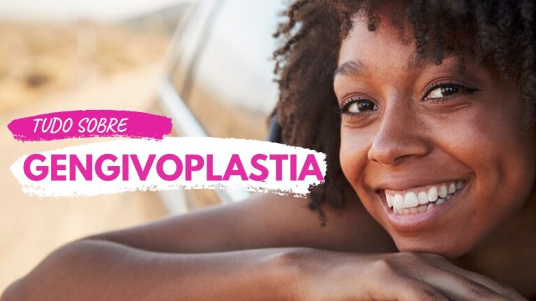 Gengivoplastia: Como é Realizada?