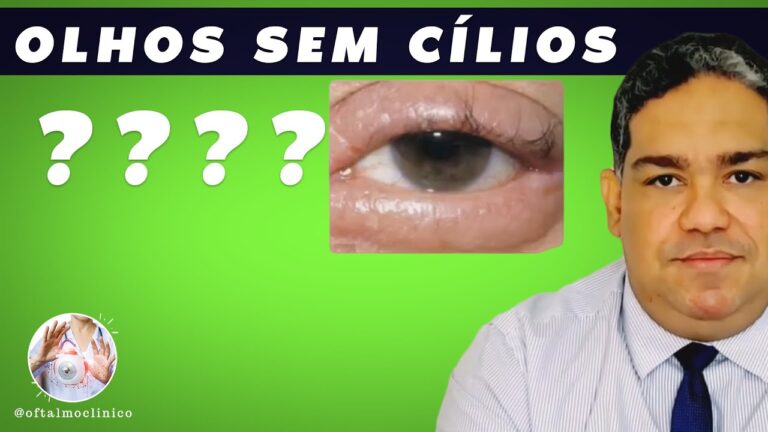 Madarose: O Que É e Como Funciona