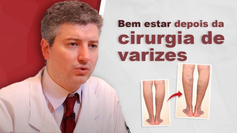 Queimação nas Pernas Após Cirurgia de Varizes: Causas e Soluções