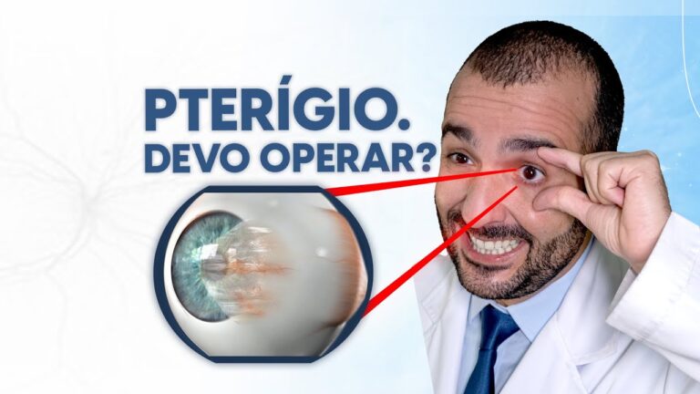 Pterígio: Conheça o Papel do Especialista na Sua Saúde Ocular