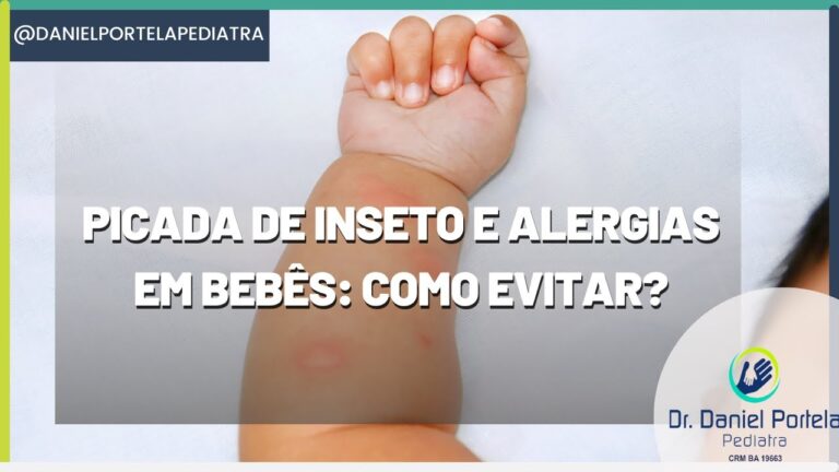 Alergia a Pernilongos em Bebês: Causas e Cuidados