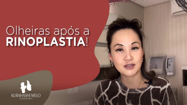 Transformação das Olheiras: Resultados da Cirurgia Antes e Depois
