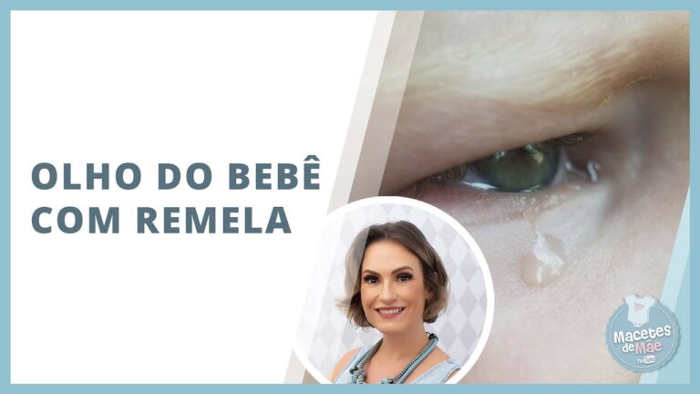 Remela nos Olhos de Bebê: Causas e Cuidados Essenciais