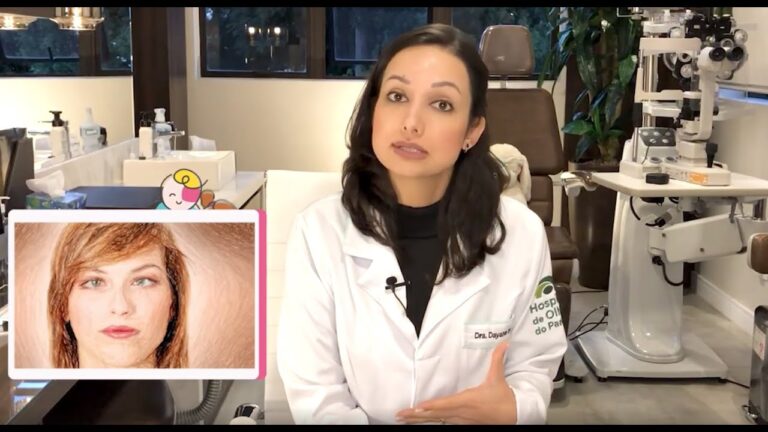 Oculistas Revelam: Óculos Eficazes para Corrigir Estrabismo