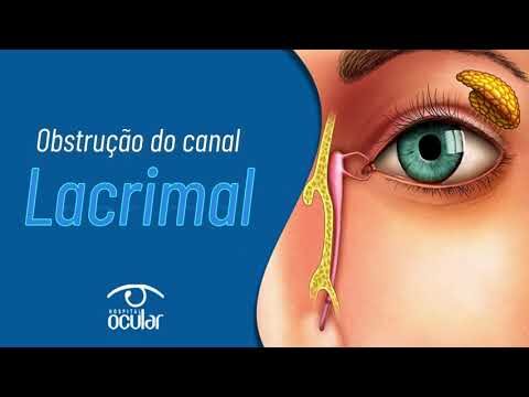 Desobstrução do Canal Lacrimal: Causas e Tratamentos Eficazes