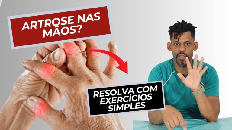 Tratamentos Eficazes para Artrose nas Mãos