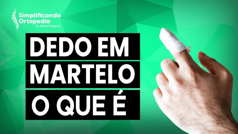 Dedo em Martelo: Causas, Sintomas e Tratamentos