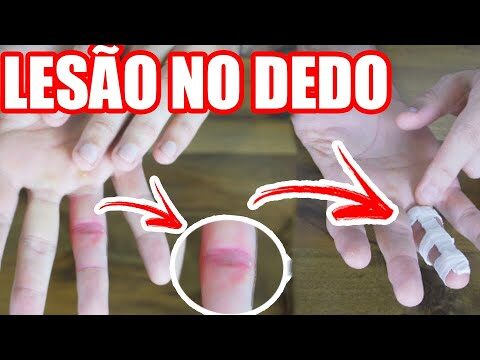Prevenção e Tratamento da Lesão no Dedo Mindinho da Mão