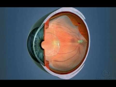 Furo na Retina: Possibilidades de Tratamento e Cura