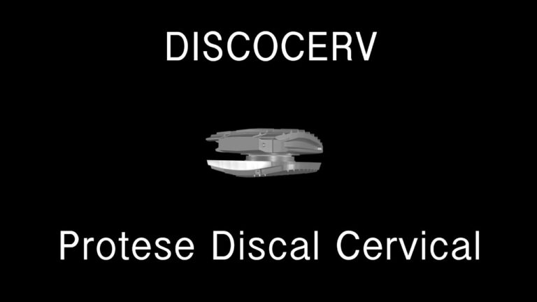 Entendendo a Prótese de Disco Cervical: Benefícios e Considerações