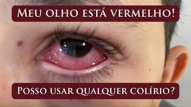 Uso Eficaz de Antibi&oacute;ticos para Infec&ccedil;&otilde;es Oculares