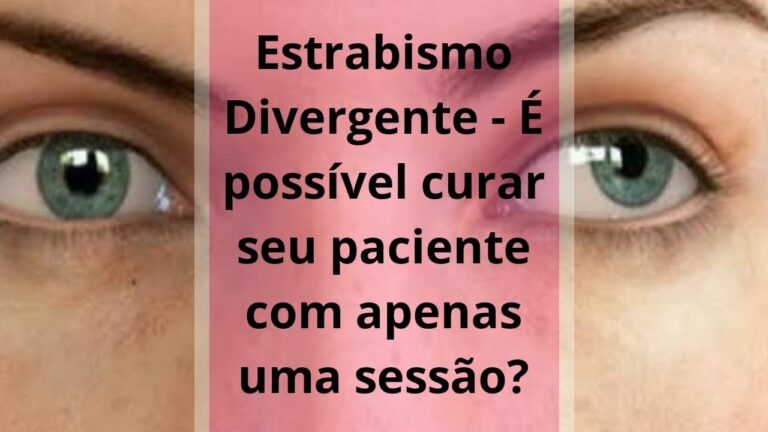 Estrabismo Divergente: Opções de Tratamento e Possibilidades de Cura