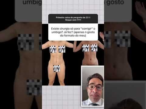 Transforma&ccedil;&otilde;es da Cirurgia no Umbigo: Antes e Depois