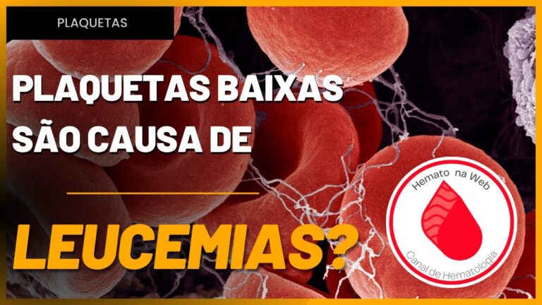Púrpura: O Risco de Evolução para Leucemia