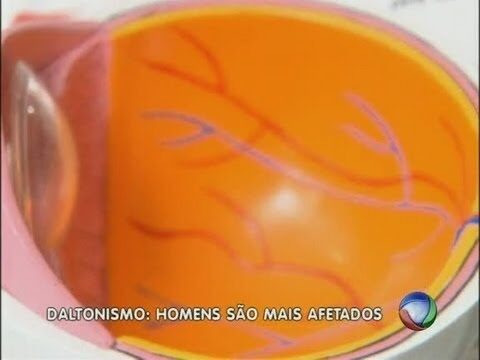 Especialistas em Daltonismo: Compreendendo e Tratando a Condição
