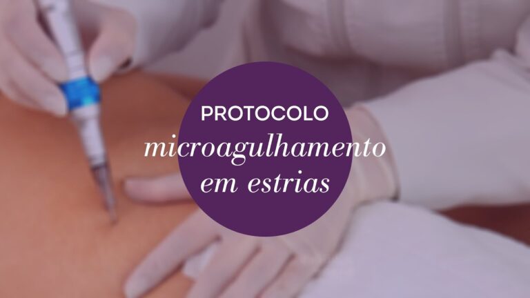 Microagulhamento: Solução Eficaz para Estrias