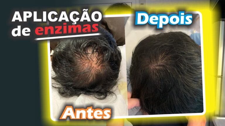 Transformação Capilar: Efeitos da Aplicação de Enzimas no Couro Cabeludo