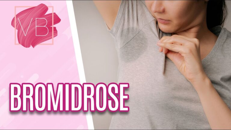 Cirurgia para Tratamento da Bromidrose: Solução Eficaz e Duradoura