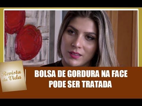 Gordurinha nos Olhos: Causas e Tratamentos Eficazes