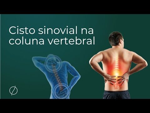 Sintomas do Cisto Sinovial na Lombar
