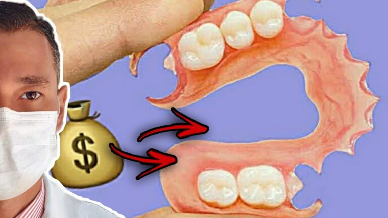 Custo da Pr&oacute;tese Dent&aacute;ria de Silicone: O Que Voc&ecirc; Precisa Saber