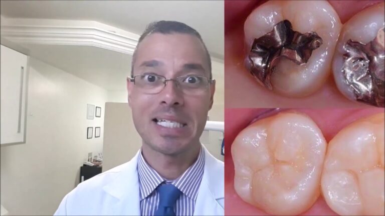 Custo da Restauração Dental: O Que Você Precisa Saber