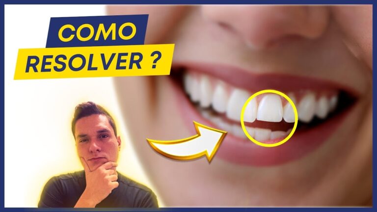 Desigualdade Dentária: Quando os Dentes da Frente São Maiores que os Outros