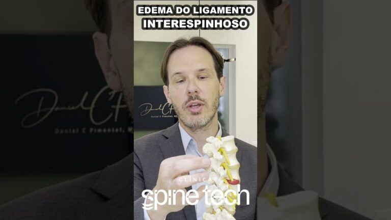 Causas e Tratamentos para Edema nas Costas