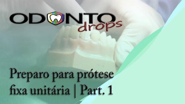 Vantagens da Prótese Fixa Unitária na Odontologia