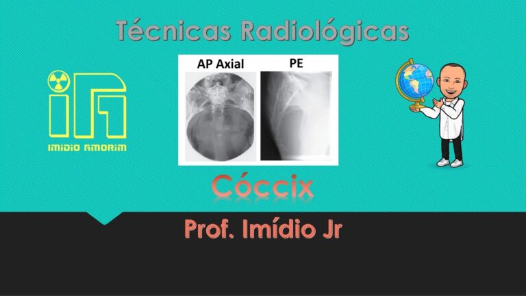 Tratamento Eficaz para a Dor no Coccix