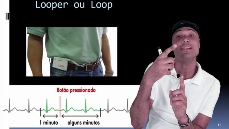 Tipos de Eletrocardiograma: Guia Completo para Compreensão e Aplicações