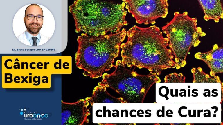 C&acirc;ncer na Bexiga: Possibilidades de Cura