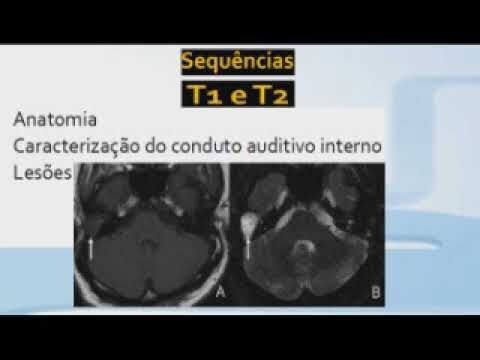 Ressonância do Ouvido: Entenda o Processo e sua Importância