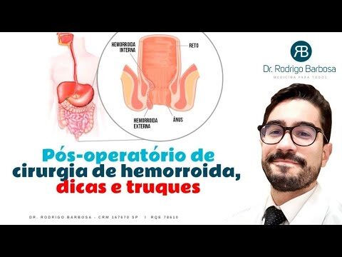 Tempo de Repouso Após Cirurgia de Hemorróidas
