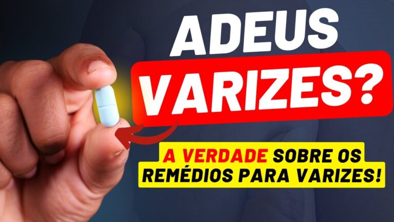 Alívio para Dor nas Pernas Causada por Varizes