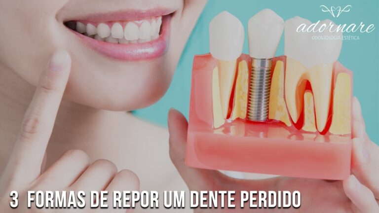 Alternativas Eficazes para Substituir um Dente Perdido