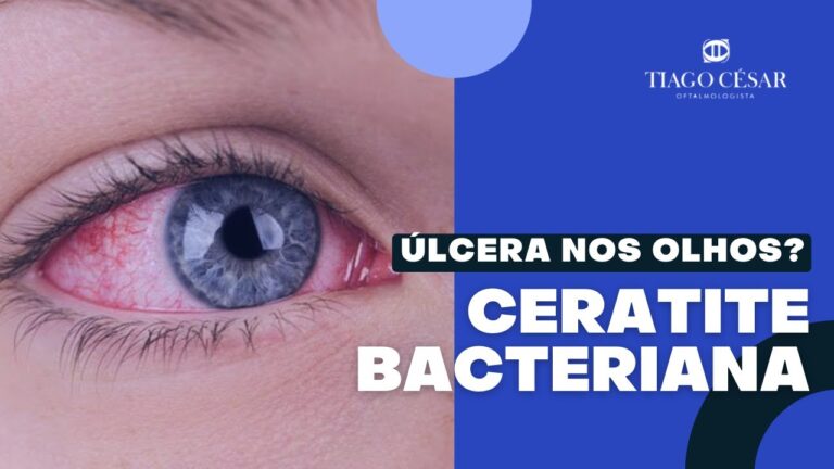 Entendendo a Úlcera no Olho: Causas e Tratamentos
