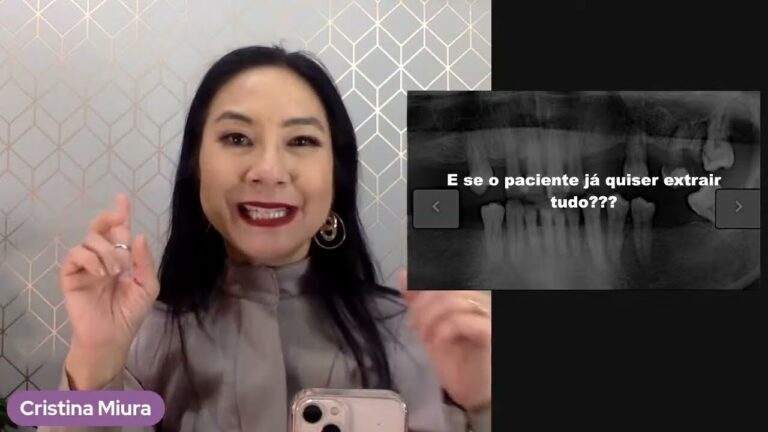 Mobilidade Dentária: Causas e Tratamentos Eficazes