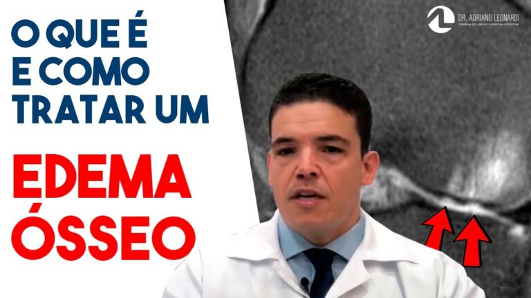Edema Subcondral no Joelho: Causas e Tratamentos