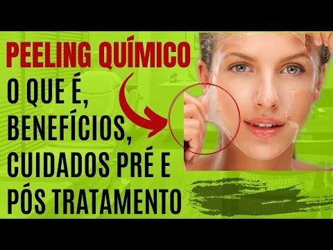 Benefícios do Peeling Químico para a Pele