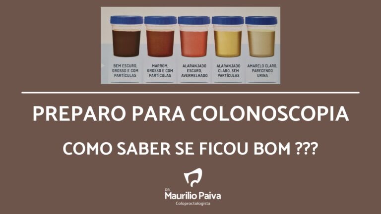 Tempo de Recuperação Após Colonoscopia: Quanto Tempo Para Evacuar?