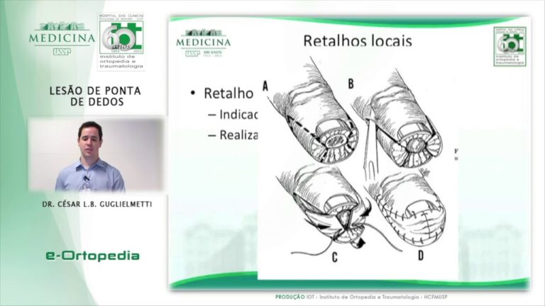 Cuidados e Tratamentos para Lesão na Ponta do Dedo
