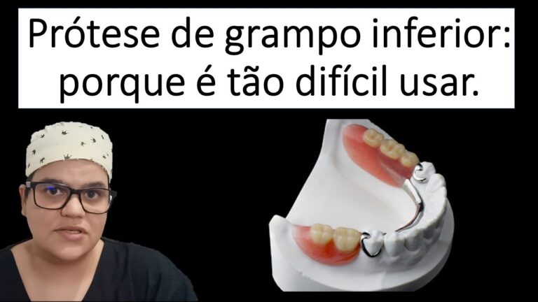 Avanços e Benefícios da Prótese Móvel Inferior