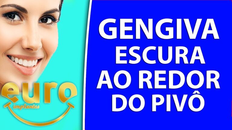 Causas e Tratamentos da Gengiva Escura ao Redor do Dente