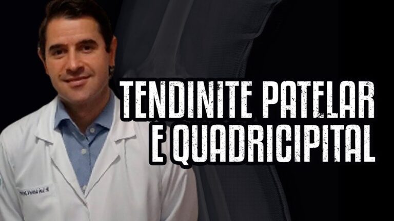 Causas e Tratamentos da Dor no Tendão Quadricipital