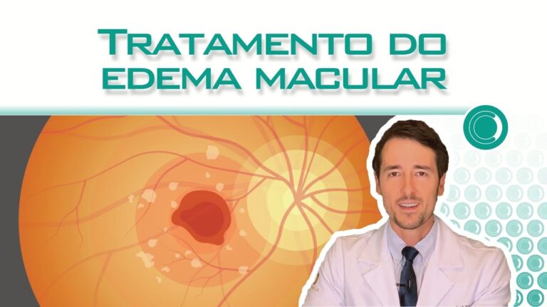 Entendendo o Edema de Mácula: Causas e Tratamentos