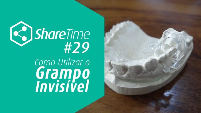 Transformando Sorrisos: A Revolução da Prótese com Grampo Invisível
