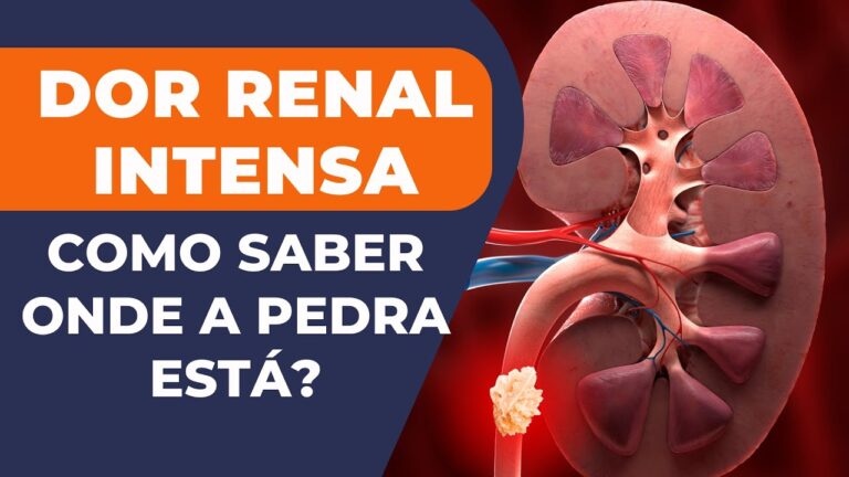 Causas e Tratamentos da Dor no Ureter