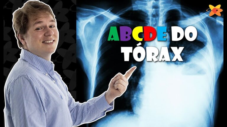 Pre&ccedil;o do Raio X do T&oacute;rax: Guia Completo